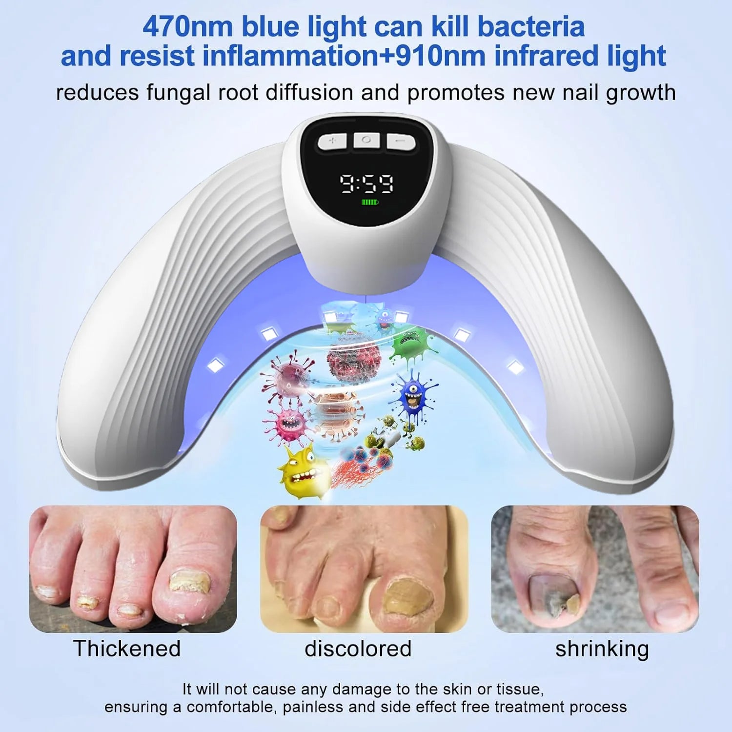 MykoCare