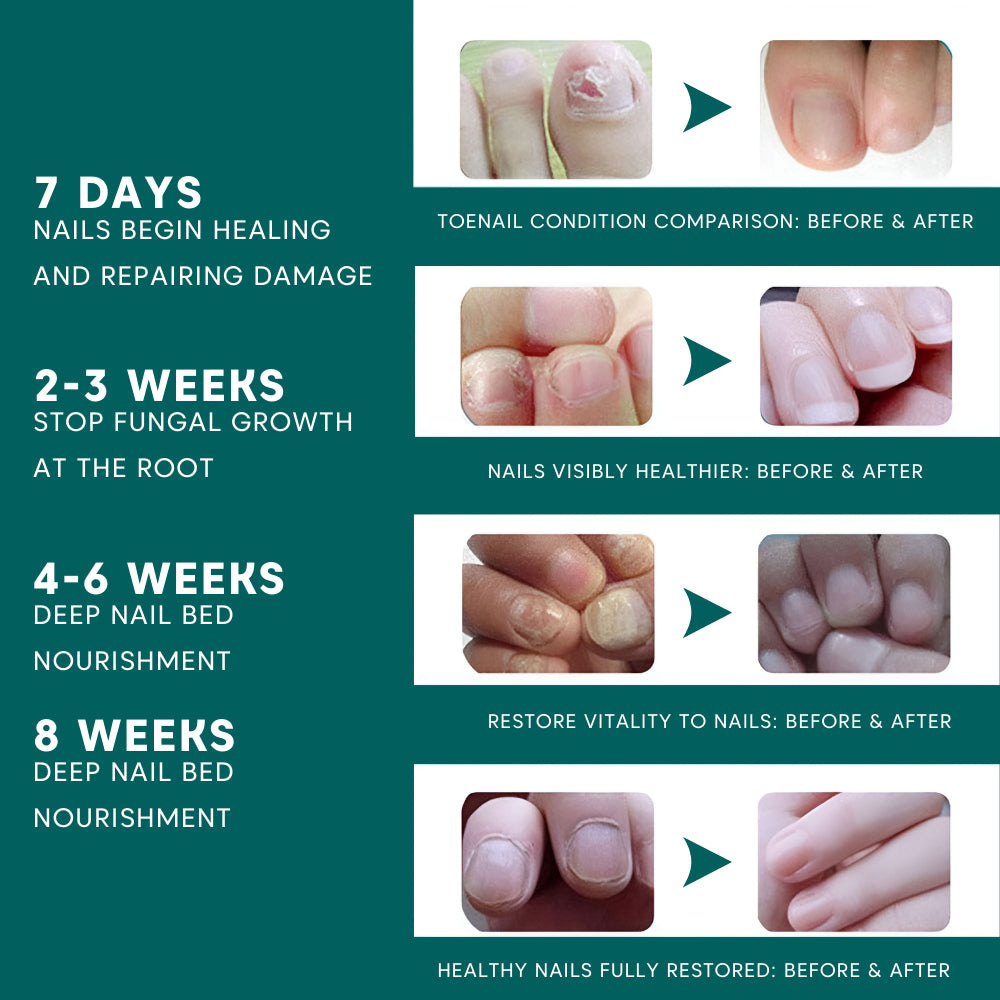 VitalPath Nail Care Pen